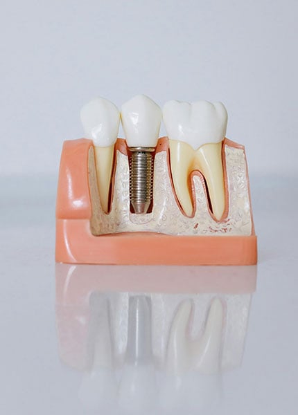 homepage-hero-dentale-2