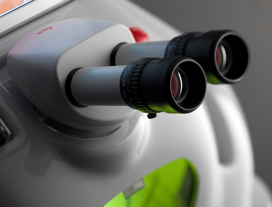 Le caratteristiche della saldatura laser